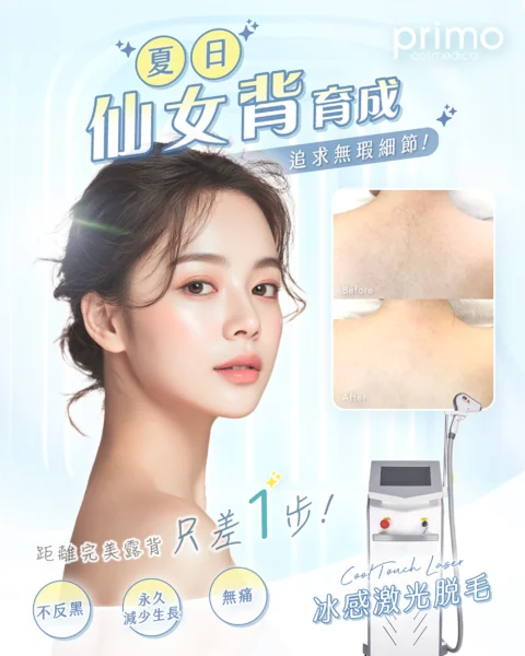 CoolTouch Laser 冰感激光脫毛