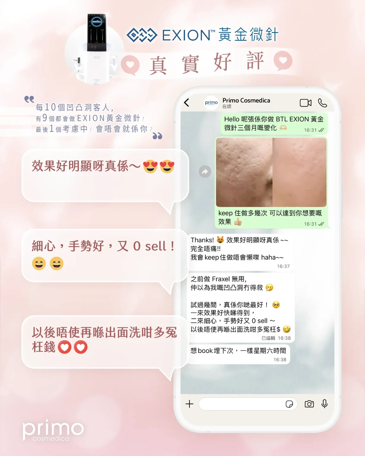 BTL EXION 用家真實好評