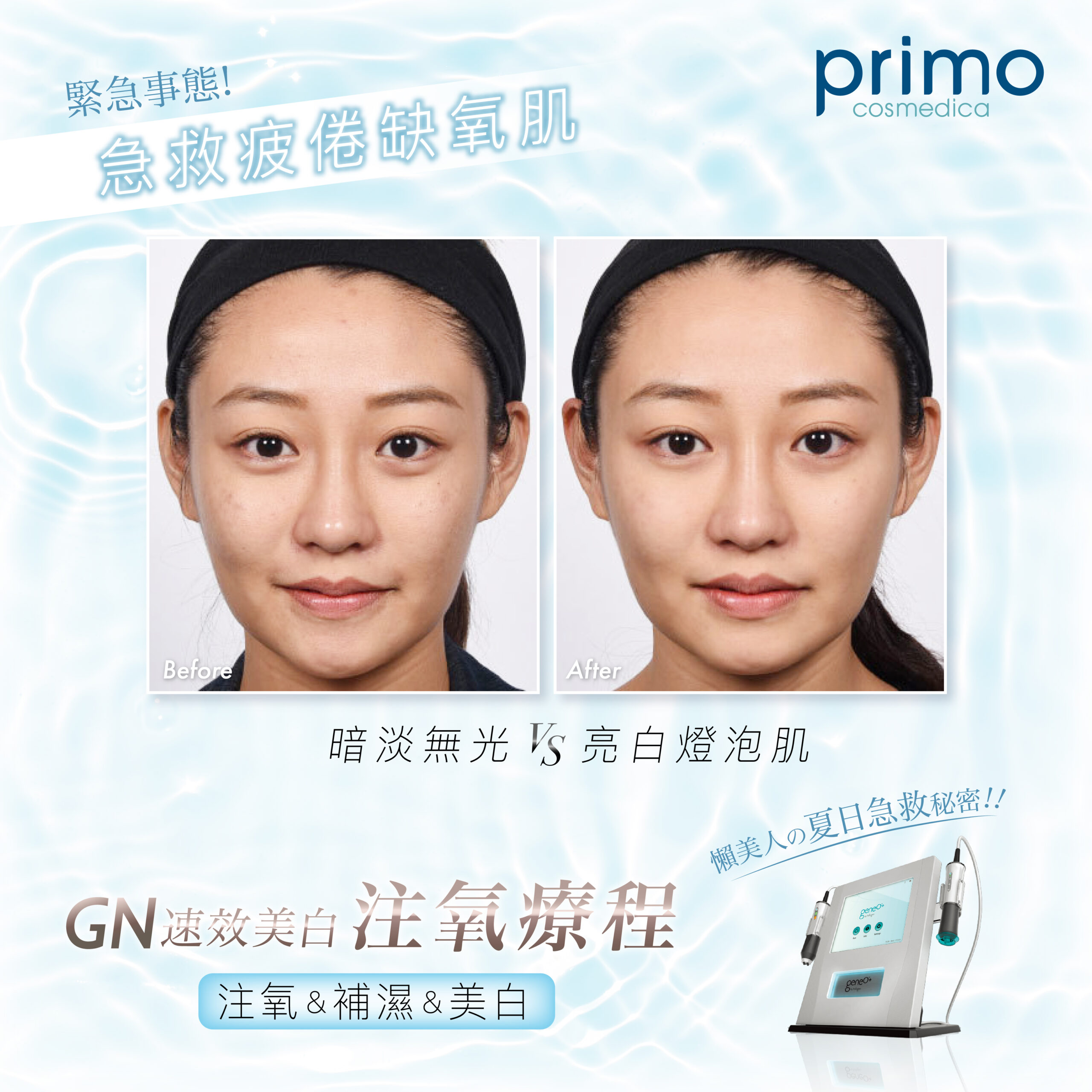 GN 速效注氧活膚療程 Before and After