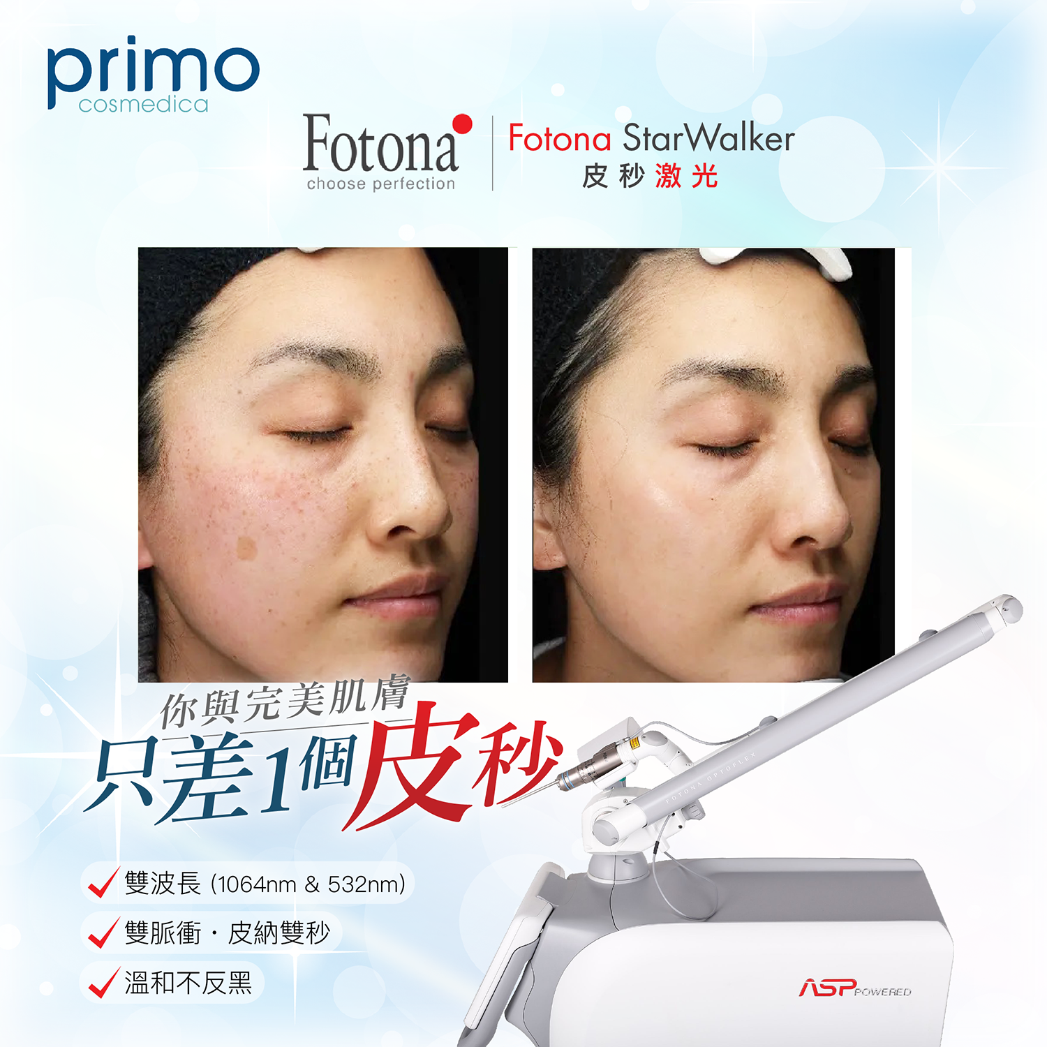 皮秒激光使用前後效果 Before After