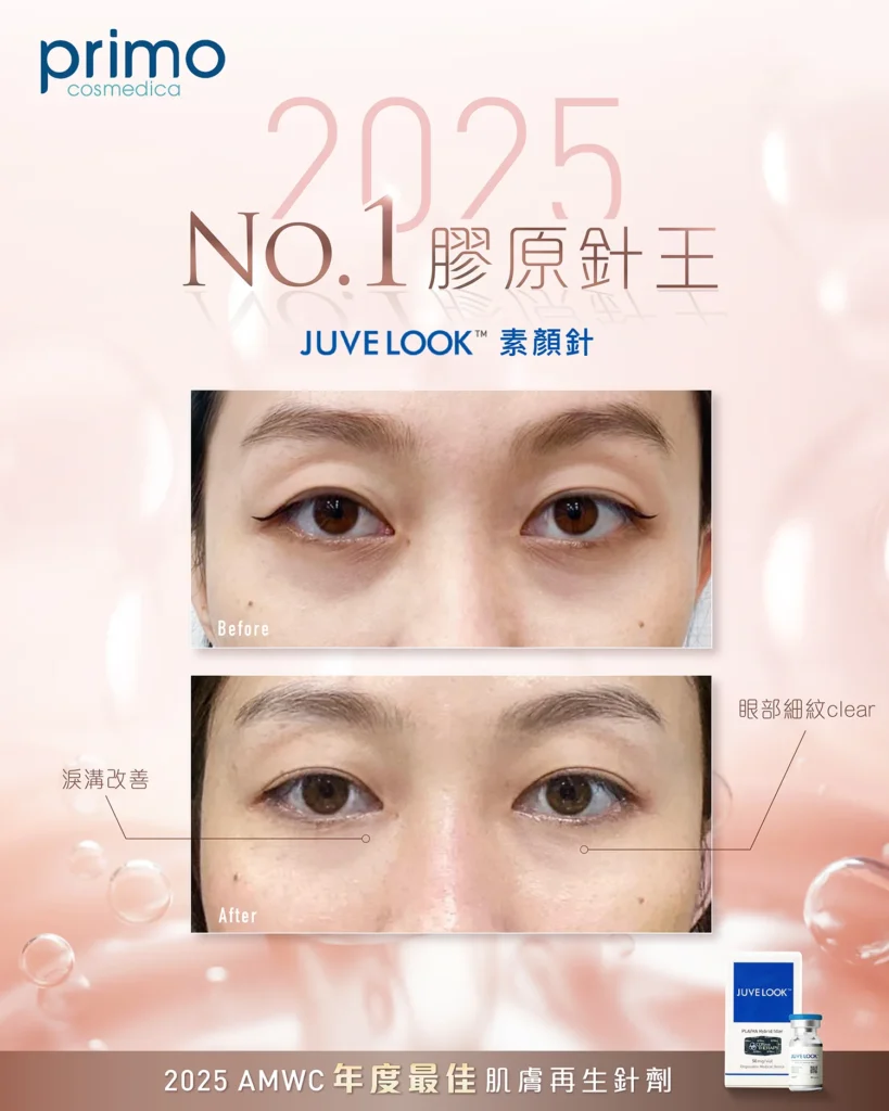 Juvelook 真實效果 Before After