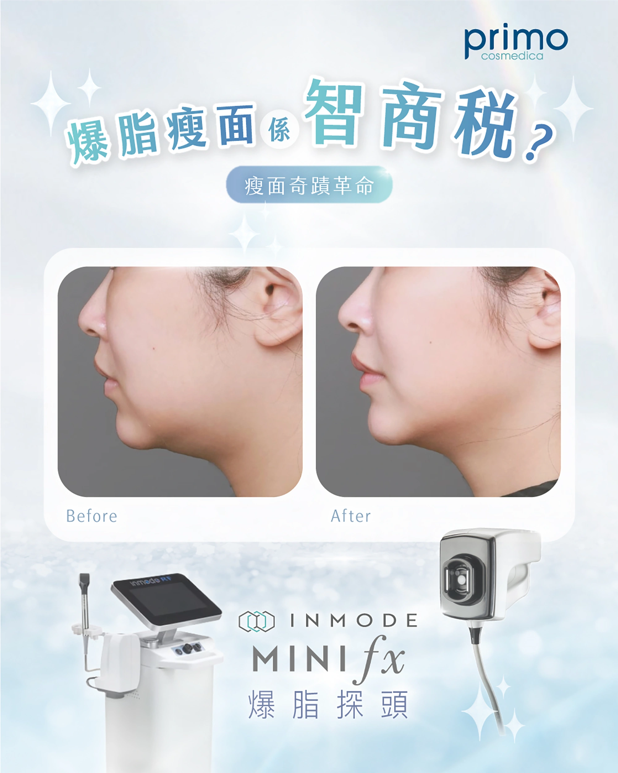 INMODE MINIFX 真實效果 Before After