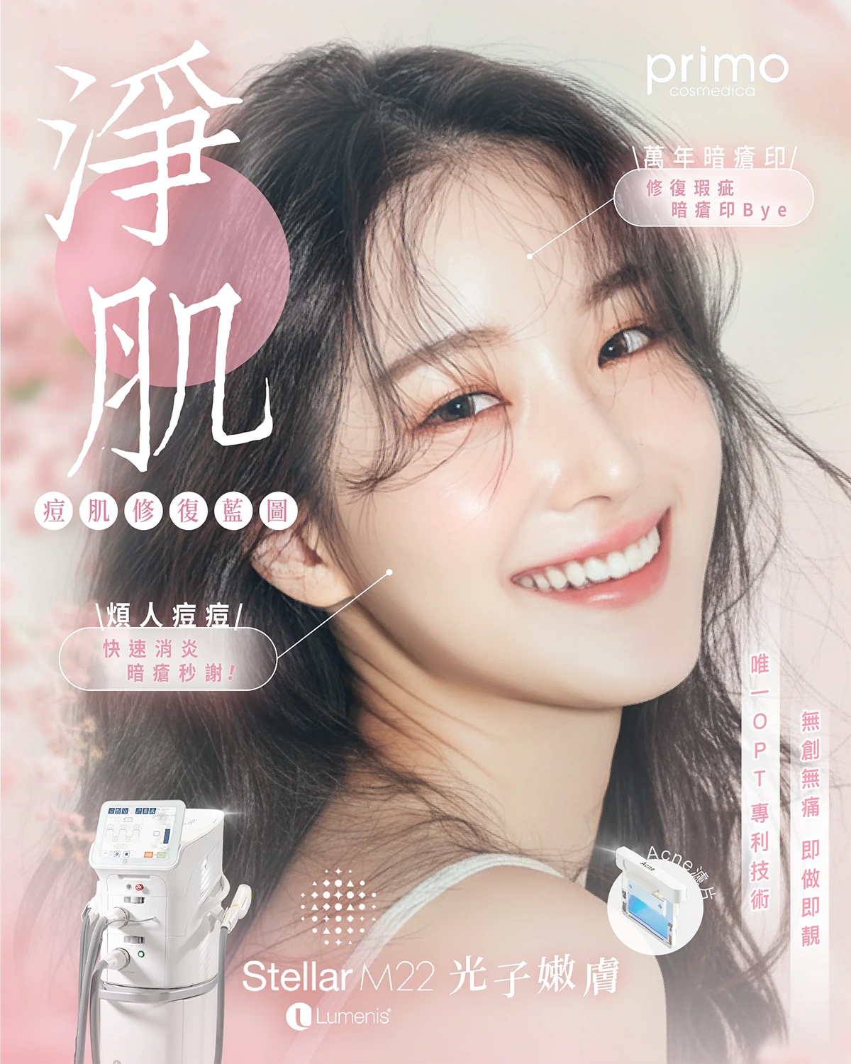 【優惠價: $1280】 Lumenis Stellar M22 光子嫩膚